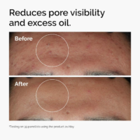 The Ordinary Niacinamide 10% + Zinc 1% - 30ml - Imagen 2